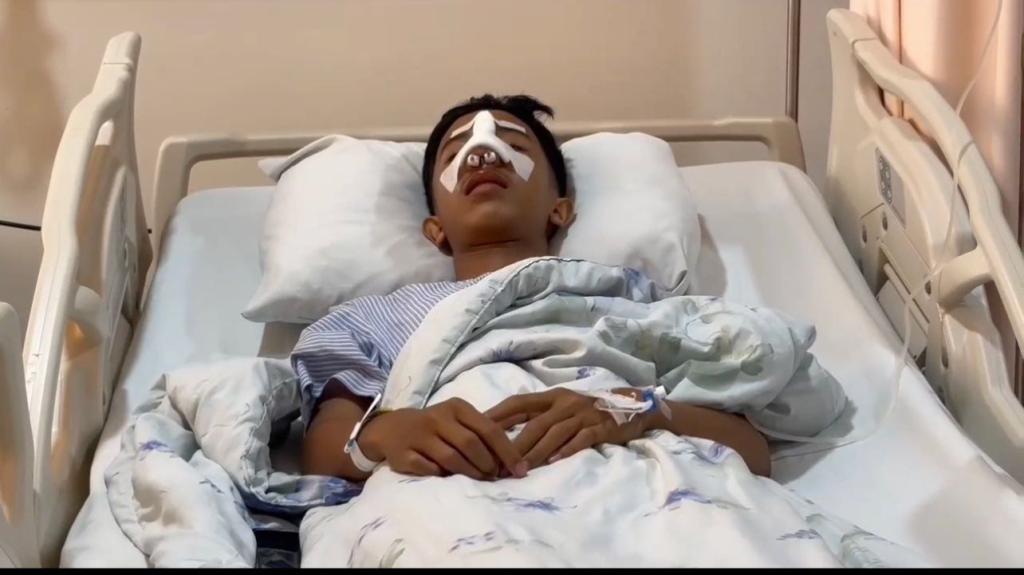 Hidung Anak Patah Akibat Berkelahi, Orang Tua Siswa SMAN 9 Putuskan Tempuh Jalur Hukum